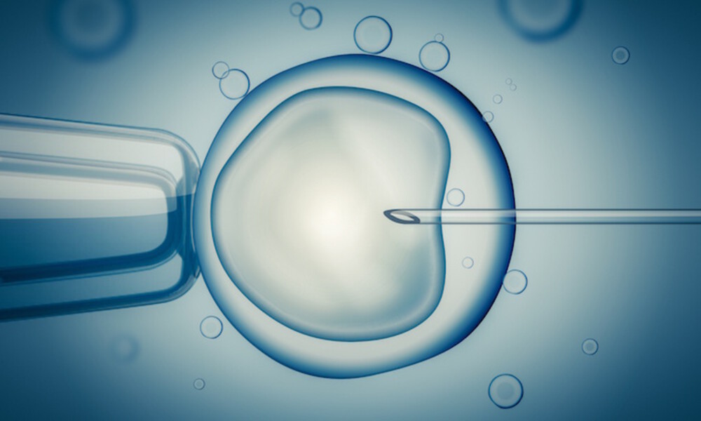 IVF advice from a fertility specialist